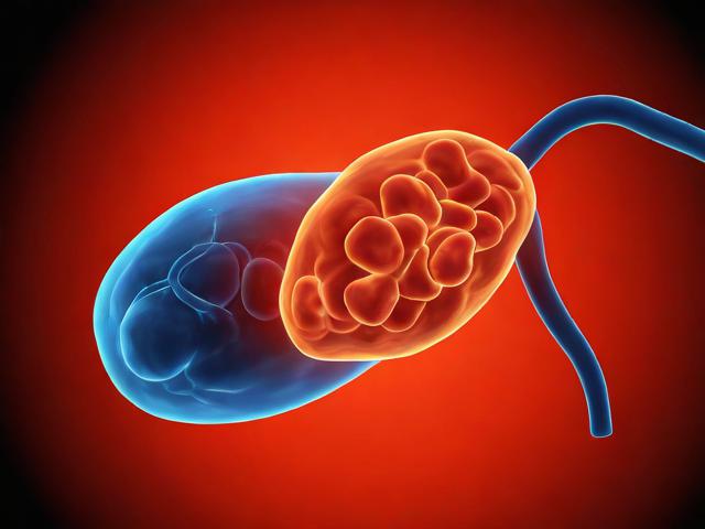 脑梗是否可获得大病补贴？